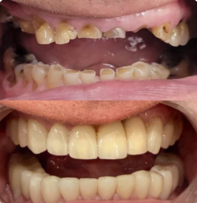 Before and after case 1